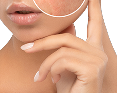 Reconstructive Surgery