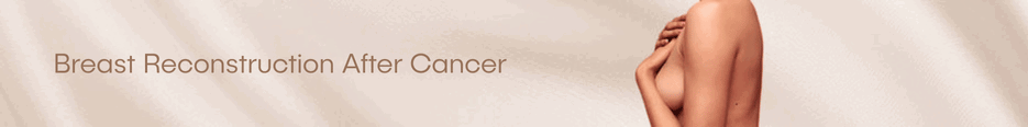 Breast Reconstruction After Cancer