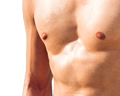 Gynecomastia: Breast Enlargement in Men